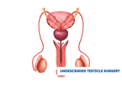 Undescended Testicle Surgery in India