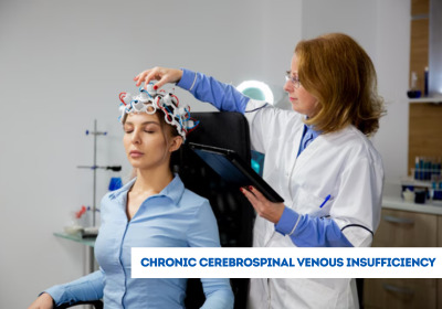 Chronic Cerebrospinal Venous Insufficiency Treatment in India
