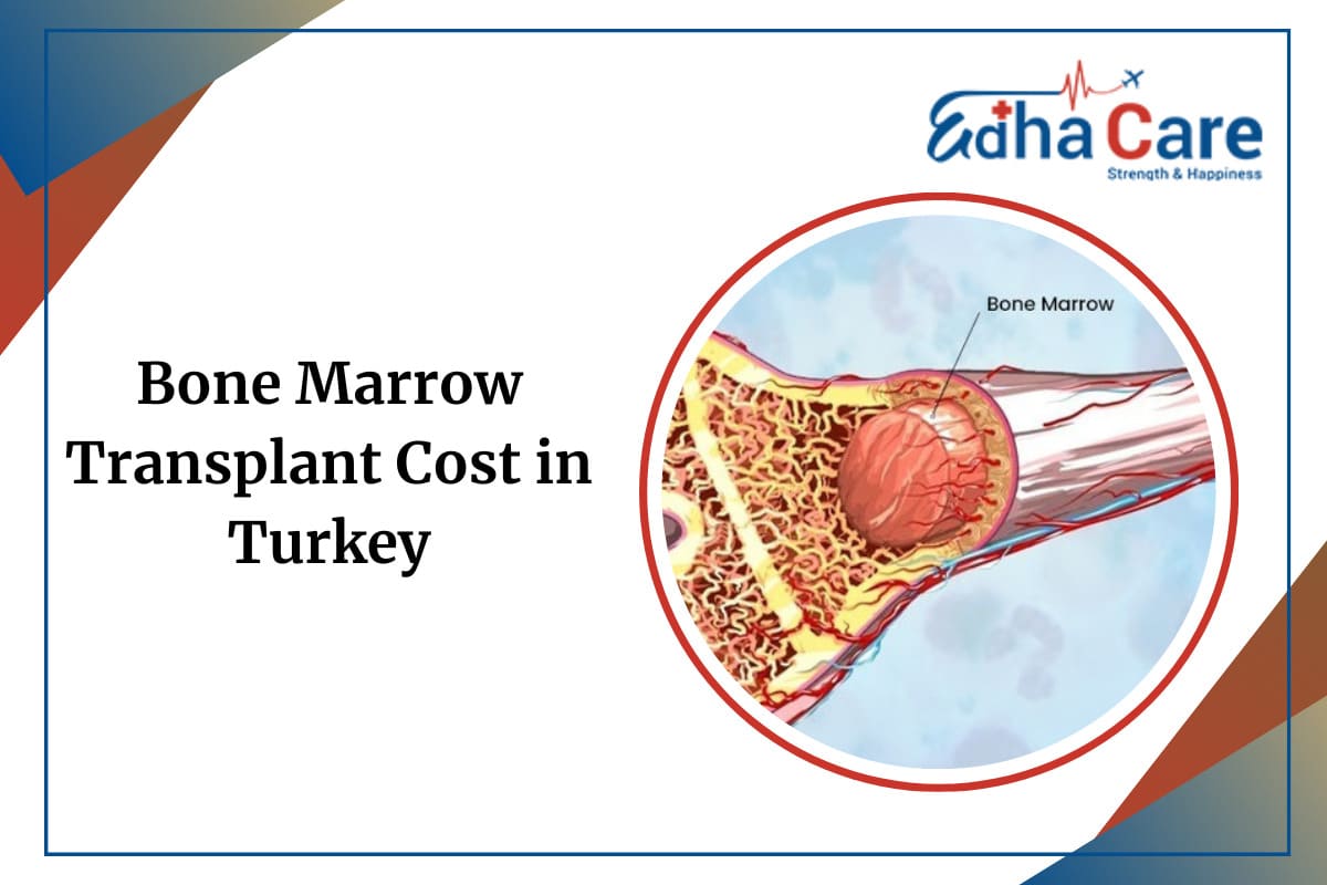 Bone Marrow Transplant Cost in Turkey
