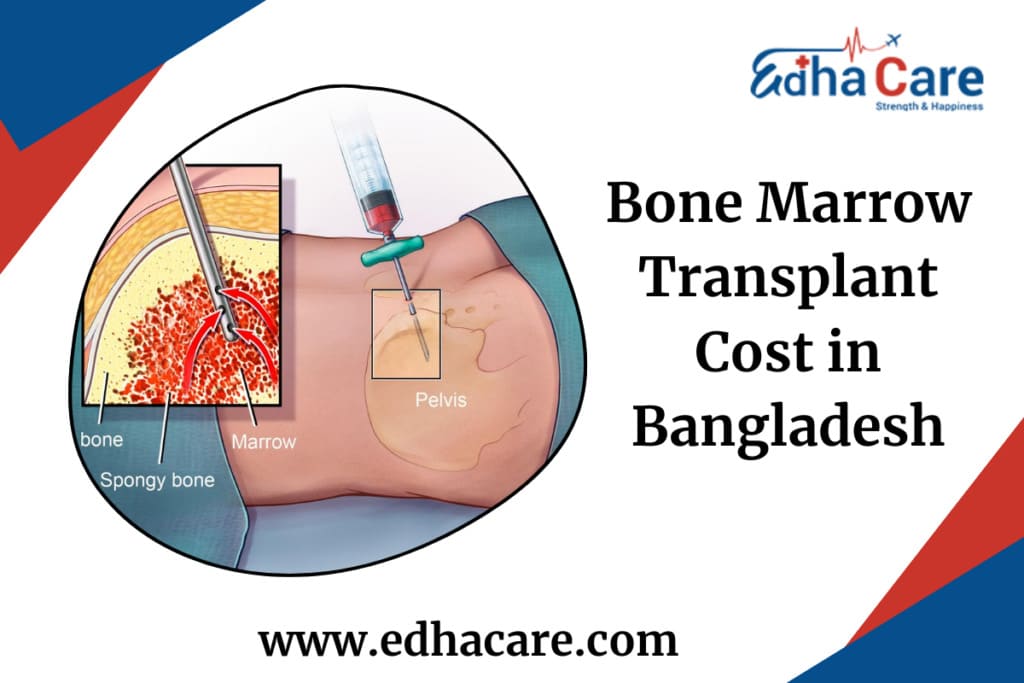 Bone Marrow Transplant Cost in Bangladesh