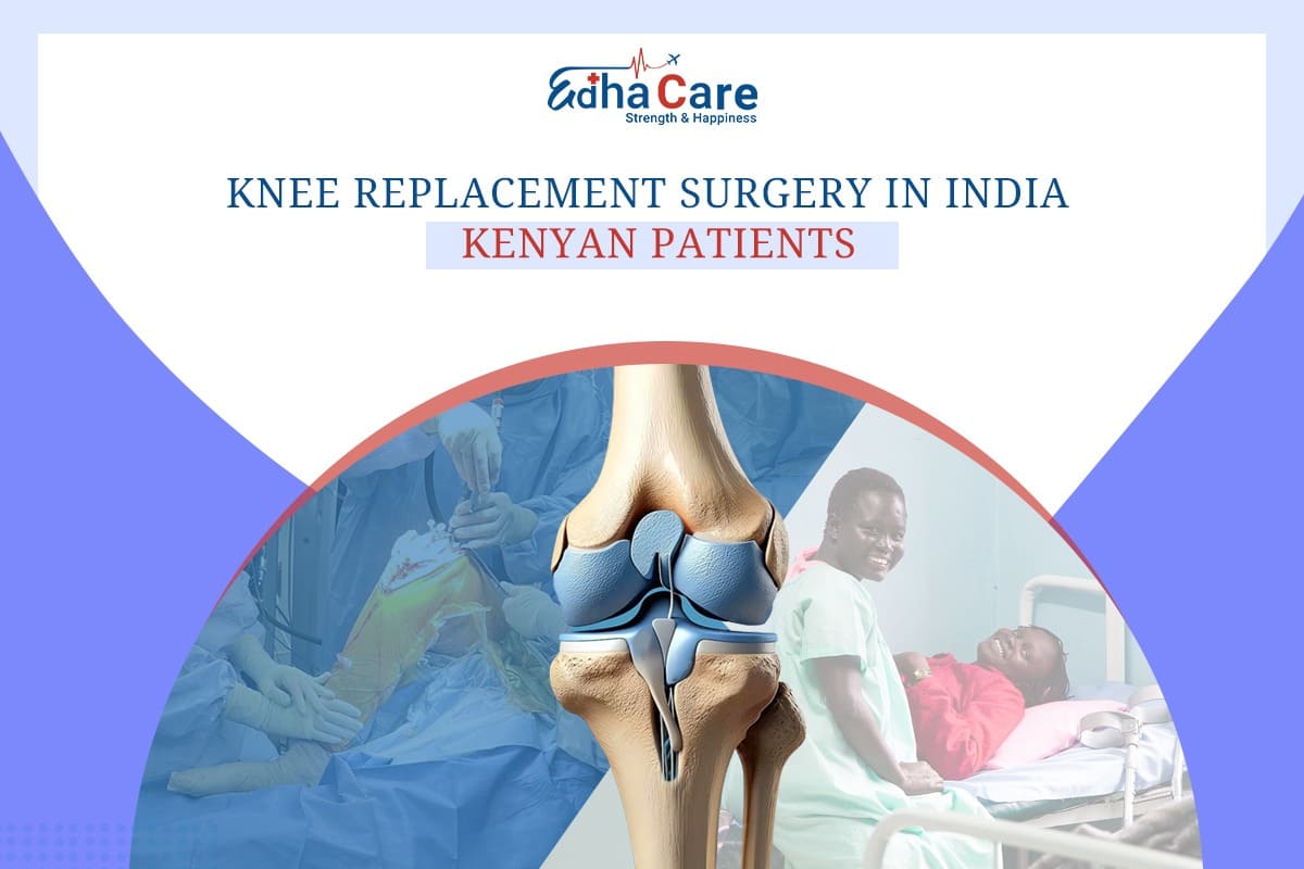 Knee Replacement Surgery in India for Kenyan Patients