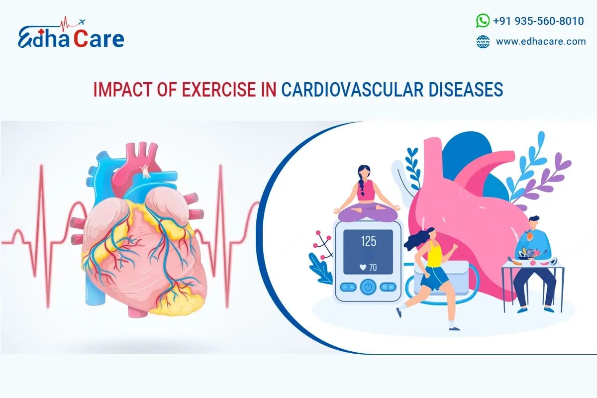 Exercise Reducing Cardiovascular Diseases