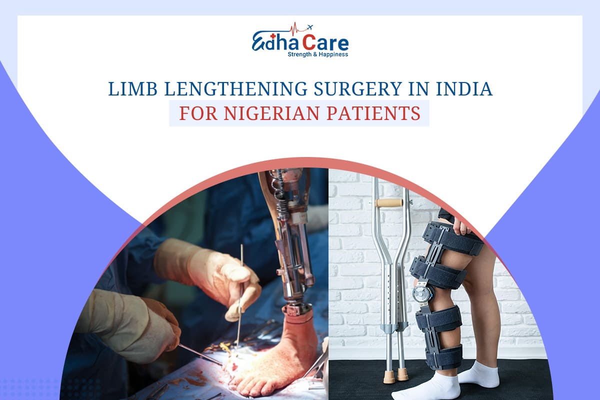Limb Lengthening Surgery in India for Nigerian Patients