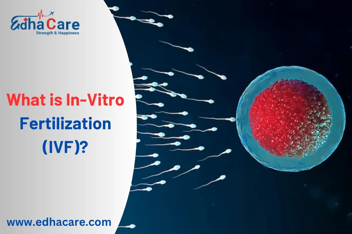 What is In-Vitro Fertilization (IVF)