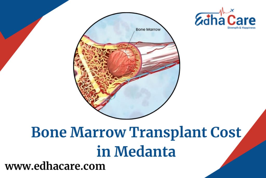 Bone Marrow Transplant Cost in Medanta