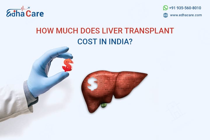 Liver Transplant Cost in India